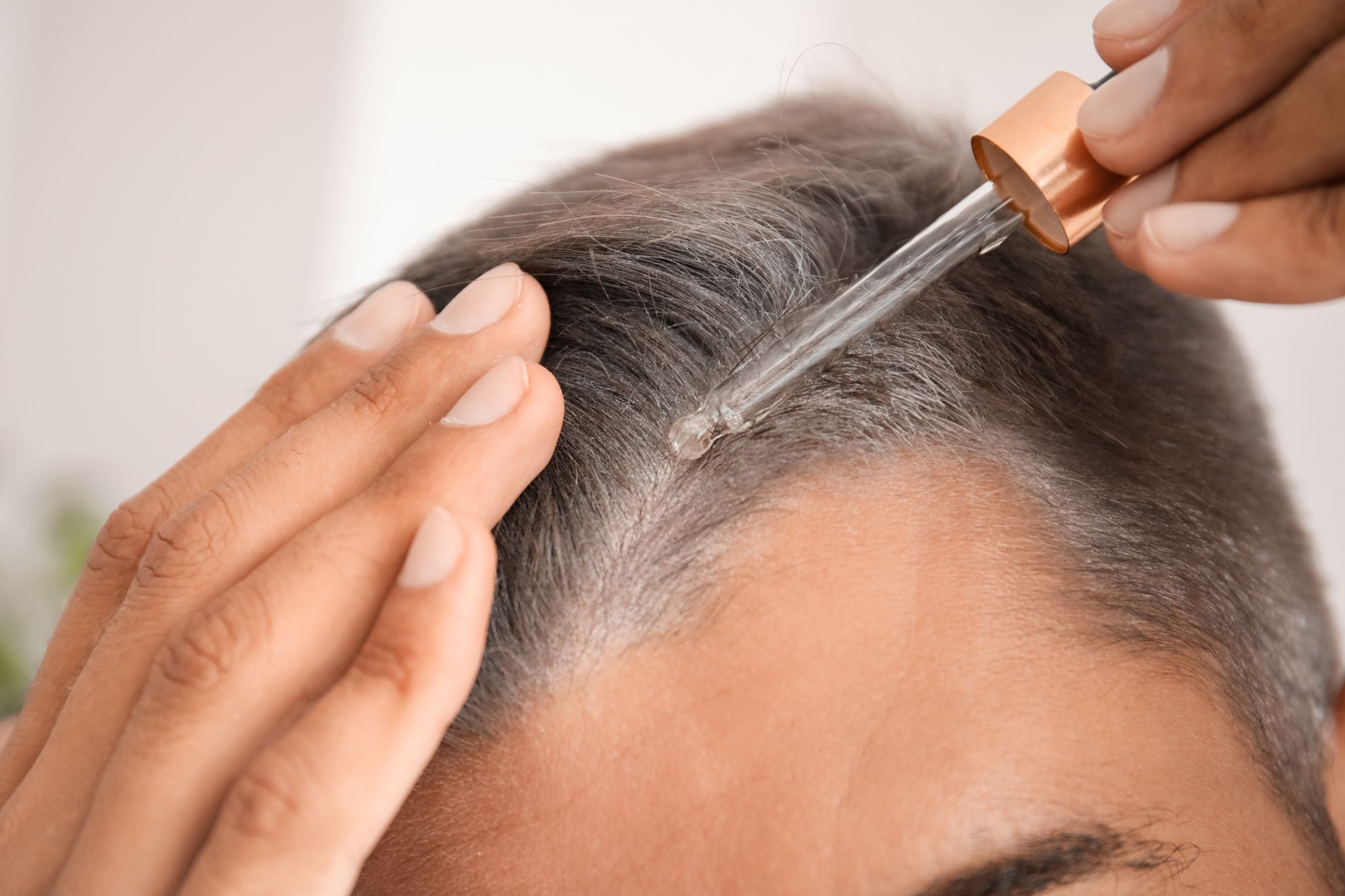 Kosmetyki na wzmocnienie cebulek włosów u mężczyzn