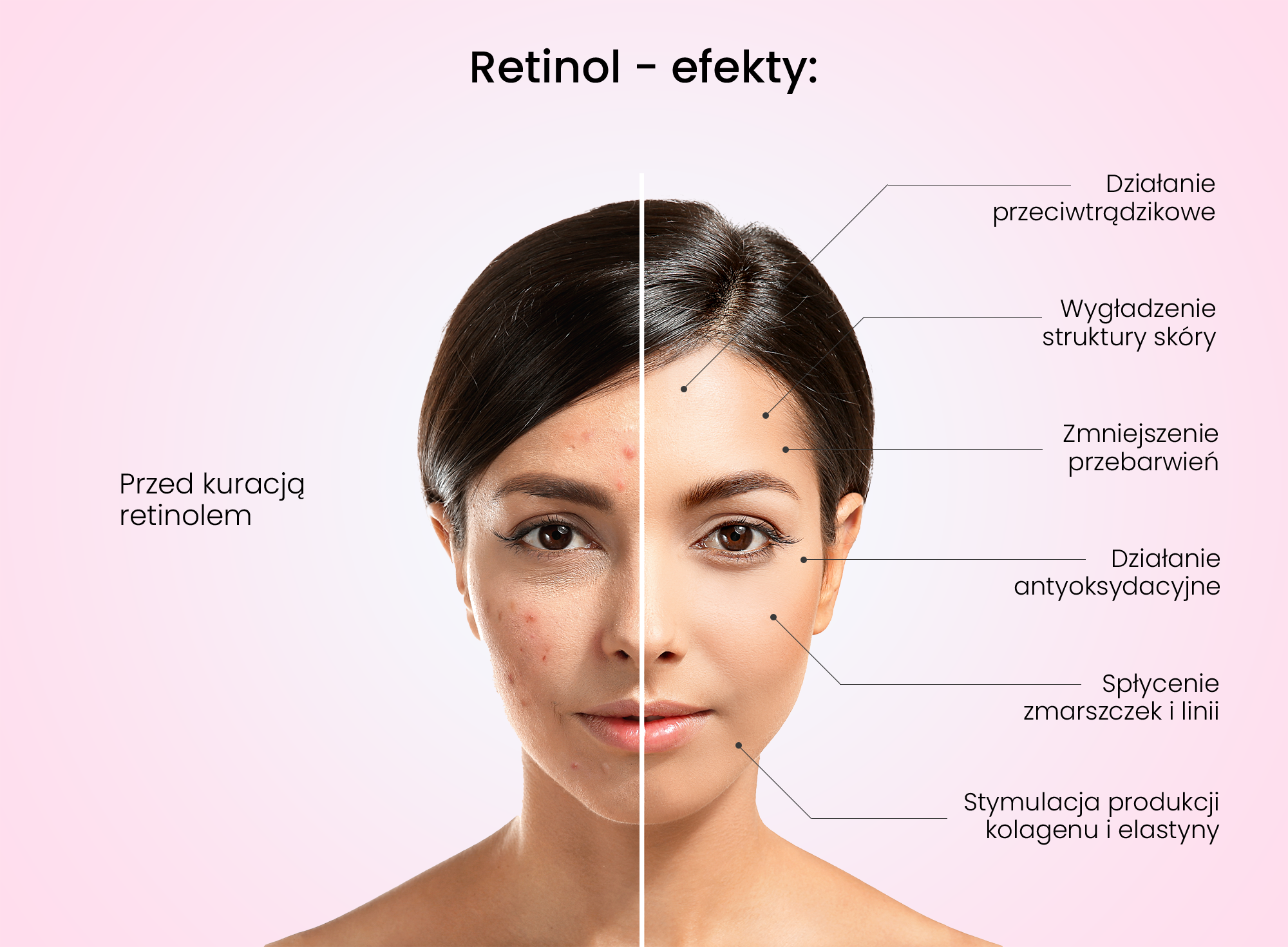 retinol efekty przed i po